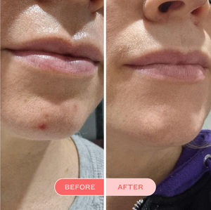 Clearing Face Wash
