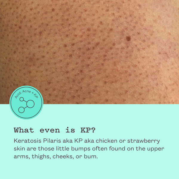 Glycolic Body Scrub