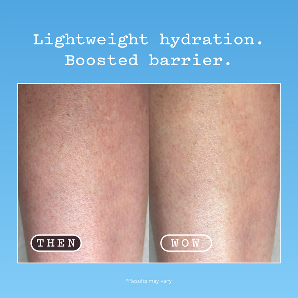 Hyaluronic Acid Body Serum