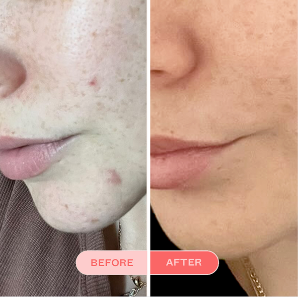 Clearing Face Wash