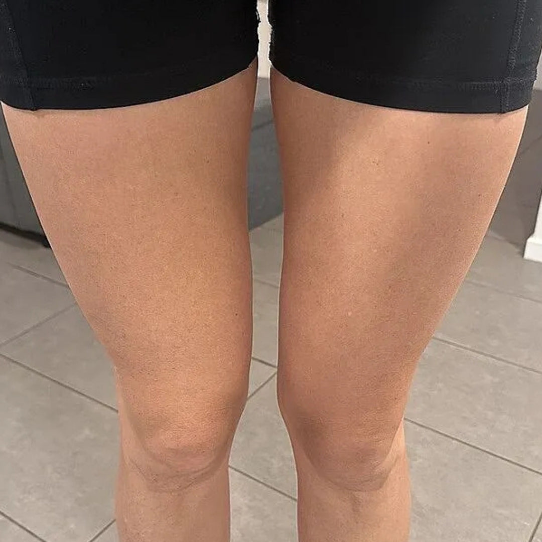 Close-up of a person's legs from the waist down, wearing black athletic shorts and standing on a light gray tiled floor.