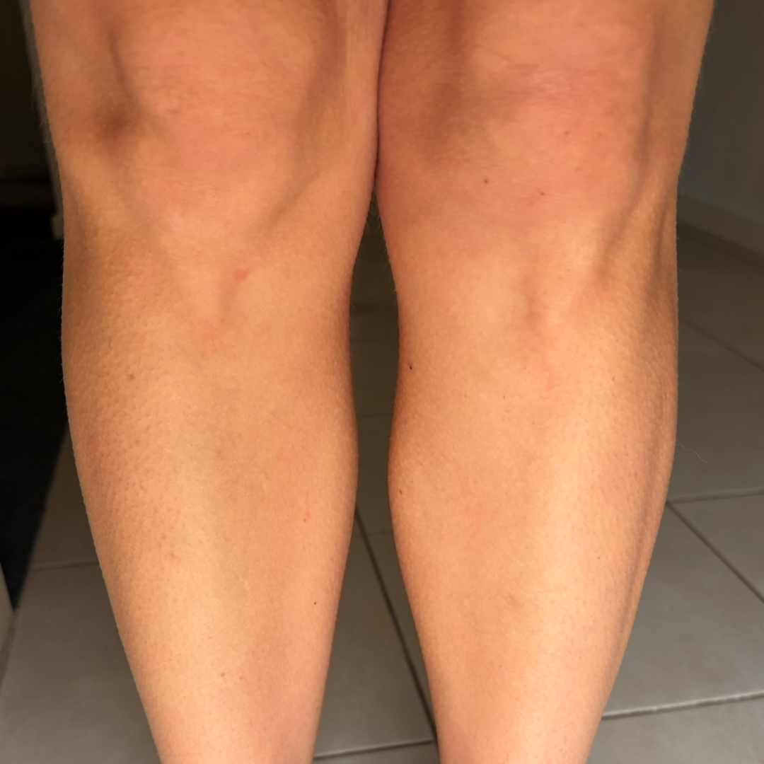 After using frank body Firm + Glow Tan Butter: bronzed, evenly tanned lower legs.