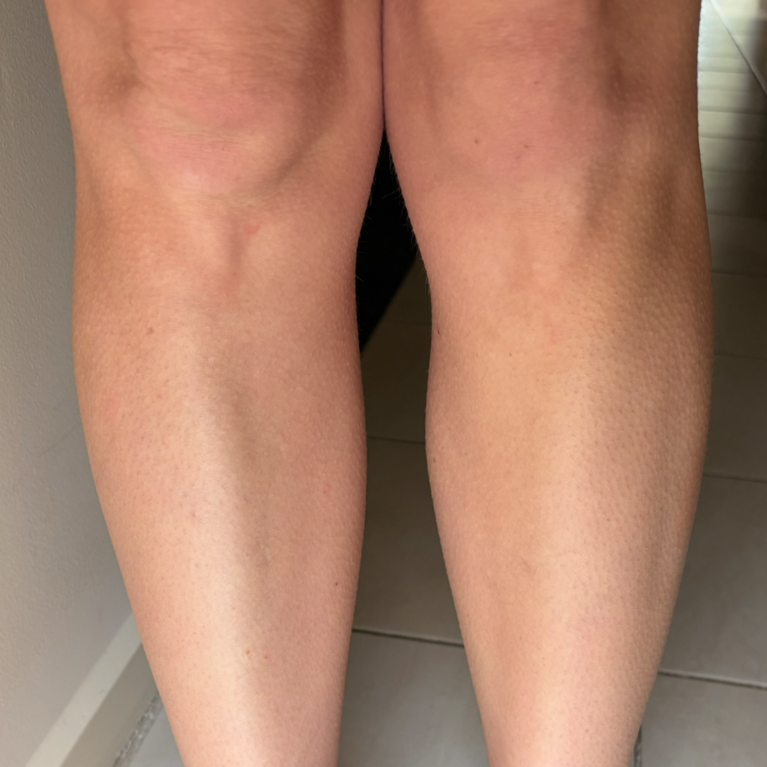 Before using frank body Firm + Glow Tan Butter: pale, untanned lower legs.