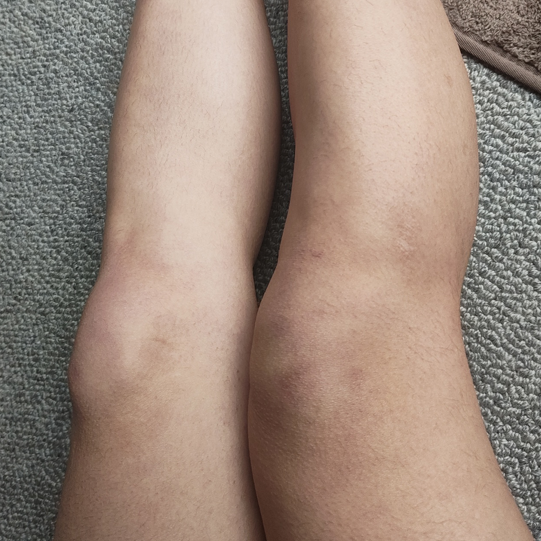 Before using frank body Firm + Glow Tan Butter: pale, untanned legs.