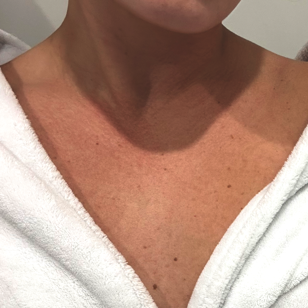 After using frank body Firm + Glow Self Tan Mousse: a bronzed, evenly tanned chest and decolletage.