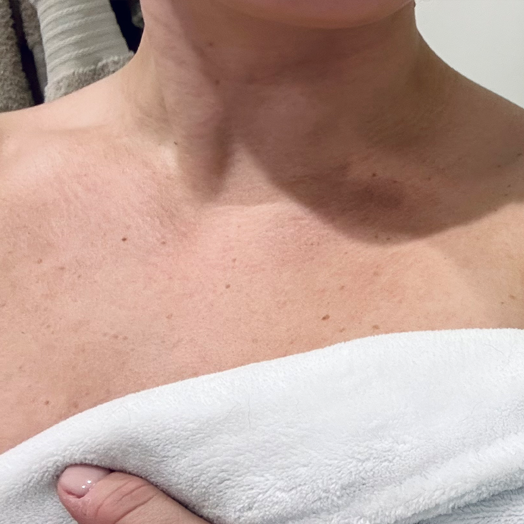 Before using frank body Firm + Glow Self Tan Mousse: a pale, untanned chest and decolletage.